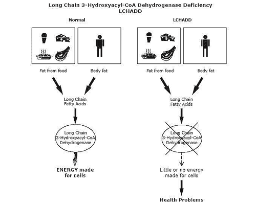 diagram of LCHAD